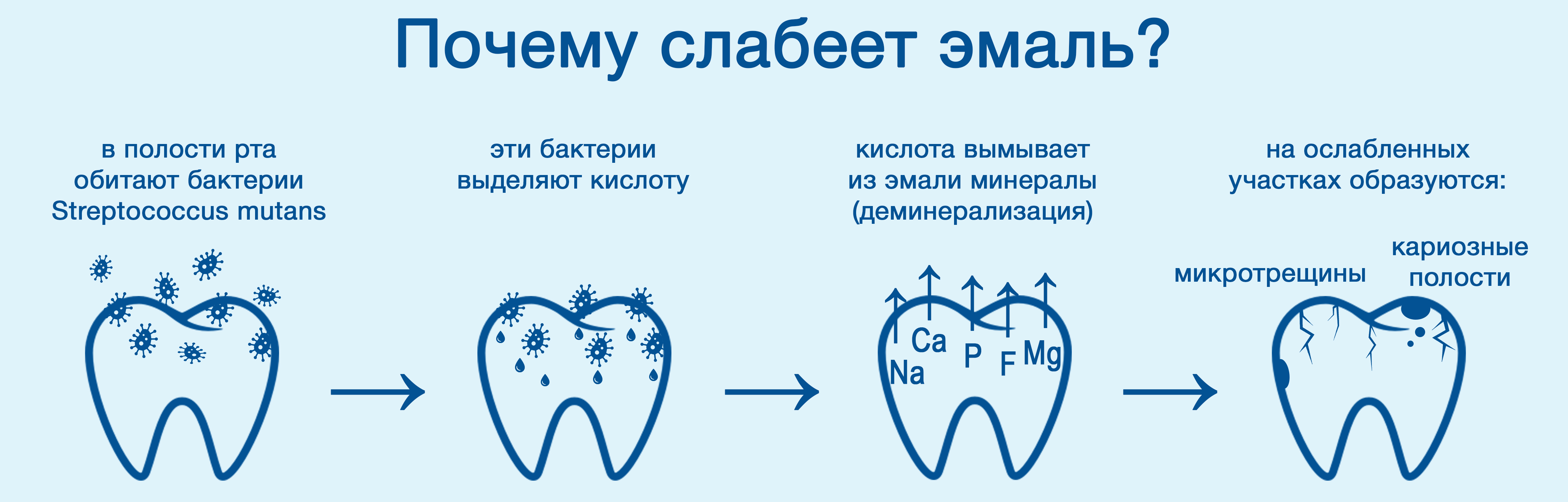 Кариес зубов деминерализация