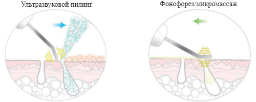 Ультразвуковая чистка лица схема