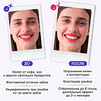 Набор для отбеливания ON WHITE Extra kit by Take a smile - изображение 2