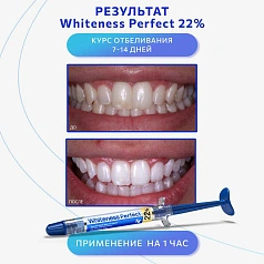 Шприц с отбеливающим гелем FGM Whiteness Perfect 22%