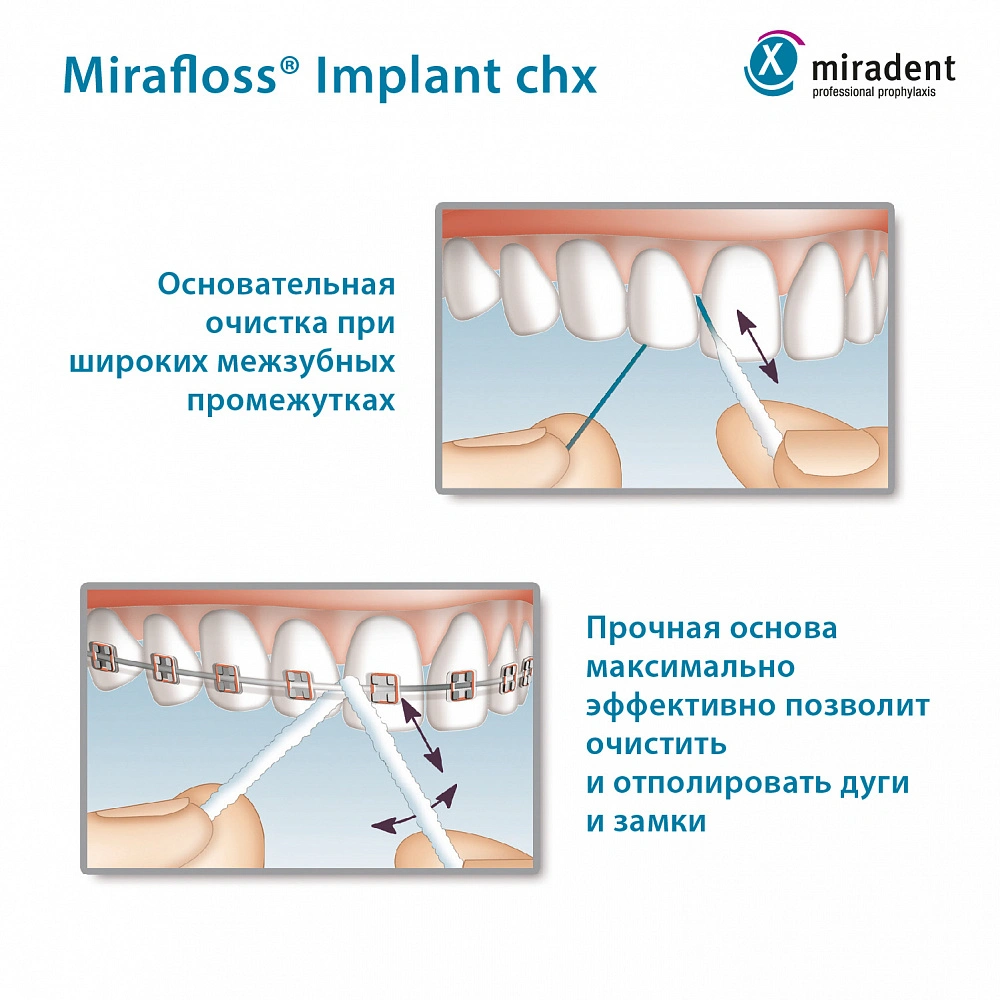 Флосс miradent Mirafloss Implant chx 2,2 мм, хлоргексидин 0,2%, для  имплантов/брекетов купить по выгодной цене