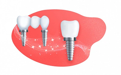 Уход за зубными имплантами