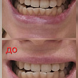 Картинка 1803642