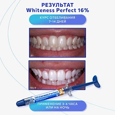 Шприц с отбеливающим гелем FGM Whiteness Perfect 16%