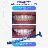 Набор для стоматологического отбеливания Whiteness Perfect 16% 