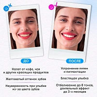Набор для отбеливания ON WHITE Little kit by Take a smile - изображение 4