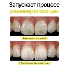 Фитогель Emra Fito Gel 20 мл + монопучковая щетка Mono Brush