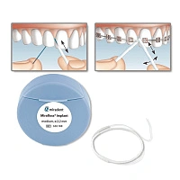 Флосс miradent Mirafloss Implant 2,2 мм, для имплантов/брекетов - изображение 3